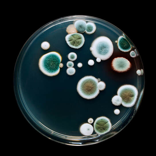 Microscopic mold in Mississuaga